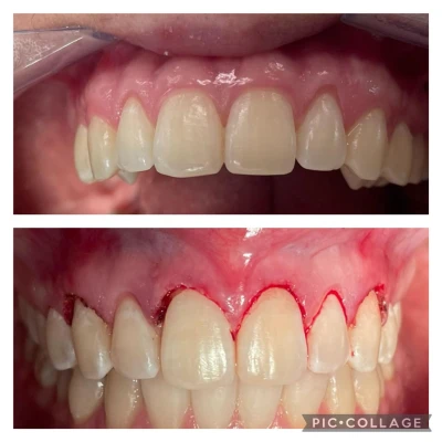 vivadent_antesdepois_2