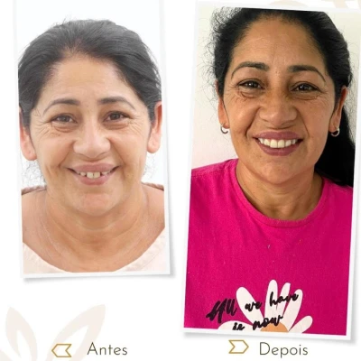 vivadent_antesdepois_5