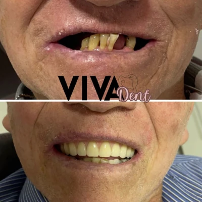 vivadent_antesdepois_9